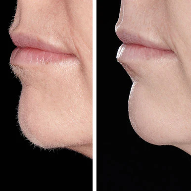 Duo Hollywood Browzer Dermaplaner- Black & Gold - Image 5