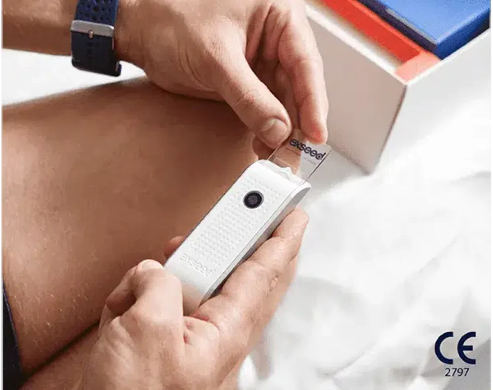 ExSeed Home Sperm Test 5 Tests - Image 6