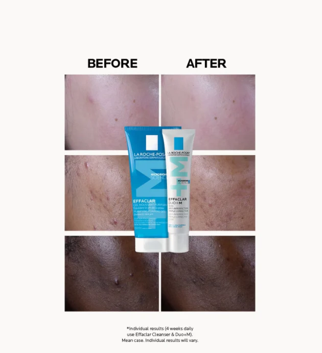 La Roche Posay Effaclar Duo+ SPF30 Anti Imperfection Moisturiser 40ml - Image 5
