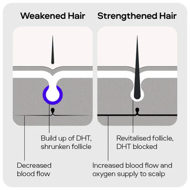 Sons DHT Blocking Hair Growth Shampoo 200ml x4 - Image 6