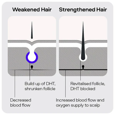 Sons Minoxidil 5% Spray 1 Month - Image 7