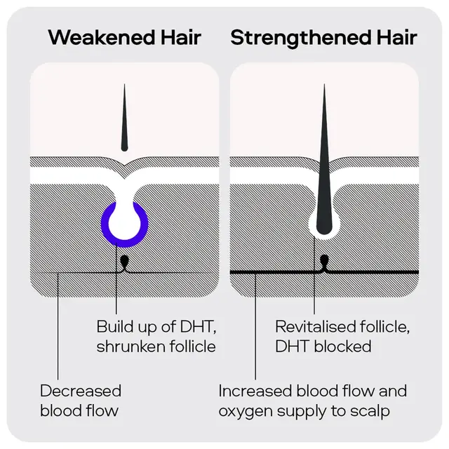 Sons Minoxidil 5% Spray 3 Pack x4 - Image 7
